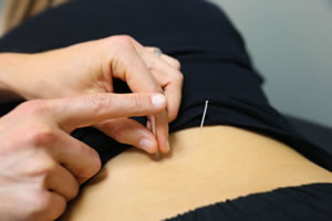Acupuncture Kansas City