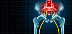 Best sciatica treatment in Kansas City, Dohrmann Chiropractic