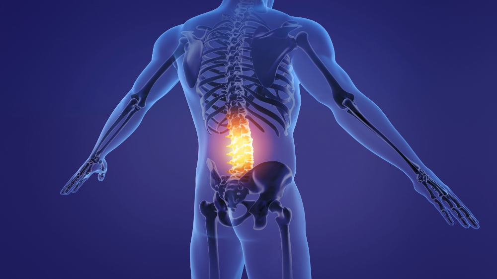 Top-rated Disc Bulge & Herniation Treatment in Kansas City at Dohrmann Chiropractic