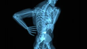 What Your Spine X-Ray Reveals About Back Pain