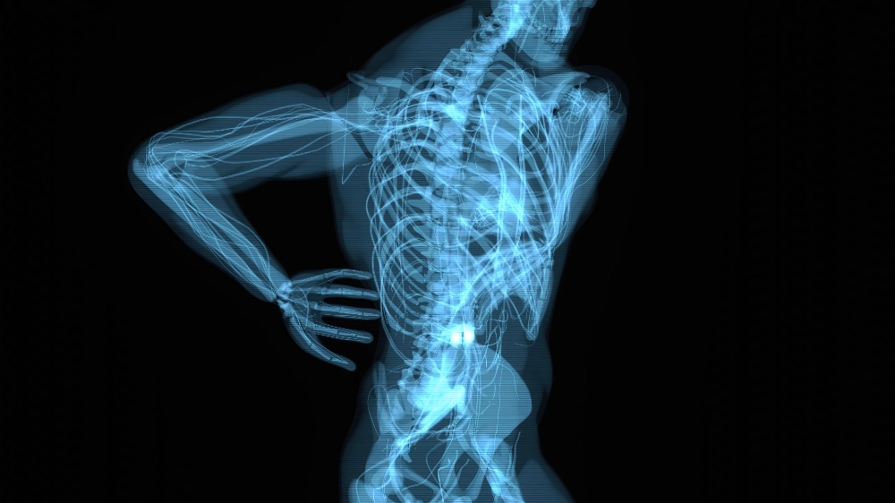 What Your Spine X-Ray Reveals About Back Pain