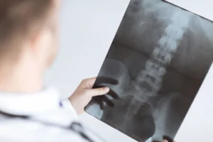 Is It Safe to Get X-Rayed at a Kansas City Chiropractor?